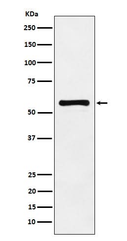 Anti-PAK2 Monoclonal Antibody Boster Bio