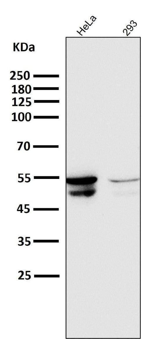Anti-Cytokeratin 8 KRT8 Rabbit Monoclonal Antibody Boster Bio