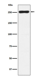 Anti-WNK1 Rabbit Monoclonal Antibody Boster Bio