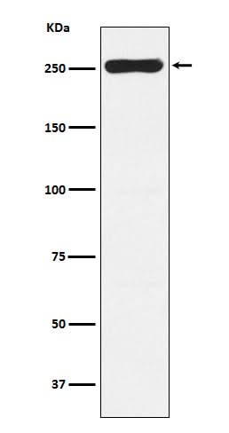 Anti-WNK1 Rabbit Monoclonal Antibody Boster Bio