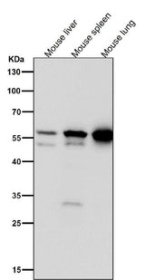 Anti-Lyn Rabbit Monoclonal Antibody Boster Bio