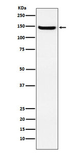 Anti-JAG2 Rabbit Monoclonal Antibody Boster Bio