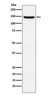 Anti-JAG2 Rabbit Monoclonal Antibody Boster Bio
