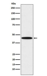 Anti-DDB2 Rabbit Monoclonal Antibody Boster Bio
