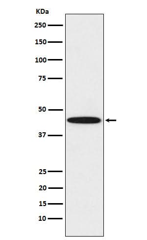 Anti-DDB2 Rabbit Monoclonal Antibody Boster Bio