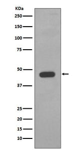 Anti-Cytokeratin 14 KRT14 Rabbit Monoclonal Antibody Boster Bio