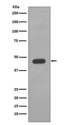 Anti-Cytokeratin 14 KRT14 Rabbit Monoclonal Antibody Boster Bio