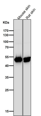 Anti-Cytokeratin 14 KRT14 Rabbit Monoclonal Antibody Boster Bio