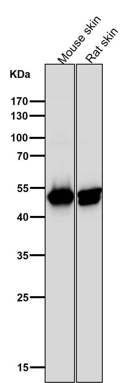 Anti-Cytokeratin 14 KRT14 Rabbit Monoclonal Antibody Boster Bio