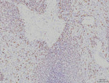 Anti-Rab11A Antibody Picoband® (monoclonal, 4H9 Boster Bio