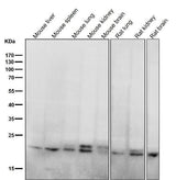 Anti-RAB11A Rabbit Monoclonal Antibody Boster Bio