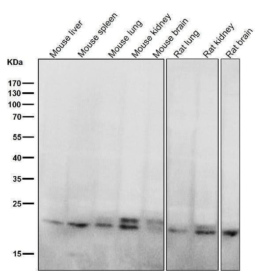 Anti-RAB11A Rabbit Monoclonal Antibody Boster Bio