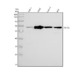 Anti-TNF Receptor II TNFRSF1B Rabbit Monoclonal Antibody Boster Bio