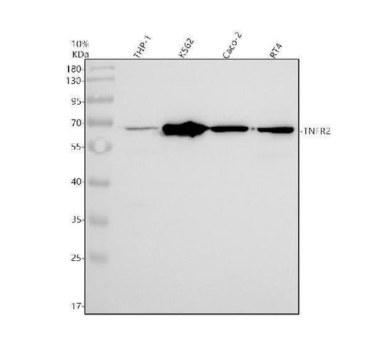 Anti-TNF Receptor II TNFRSF1B Rabbit Monoclonal Antibody Boster Bio