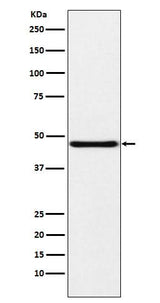 Anti-NPHS2 Rabbit Monoclonal Antibody Boster Bio