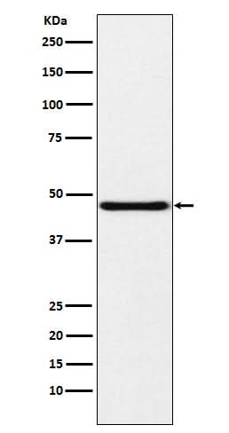 Anti-NPHS2 Rabbit Monoclonal Antibody Boster Bio