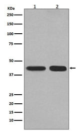 Anti-PGK1 Rabbit Monoclonal Antibody Boster Bio
