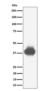 Anti-CD32A + CD32B + CD32C Rabbit Monoclonal Antibody Boster Bio