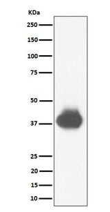 Anti-CD32A + CD32B + CD32C Rabbit Monoclonal Antibody Boster Bio