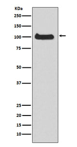 Anti-PKC mu Rabbit Monoclonal Antibody Boster Bio