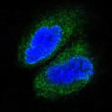 Anti-MAP3K7 Monoclonal Antibody Boster Bio