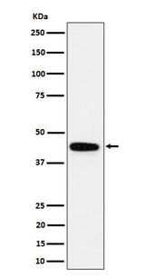 Anti-GALT Rabbit Monoclonal Antibody Boster Bio