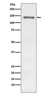 Anti-Raptor RPTOR Rabbit Monoclonal Antibody Boster Bio