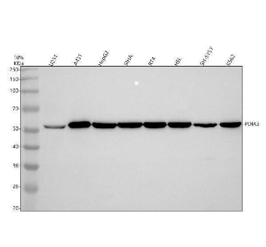 Anti-ERp57 PDIA3 Rabbit Monoclonal Antibody Boster Bio