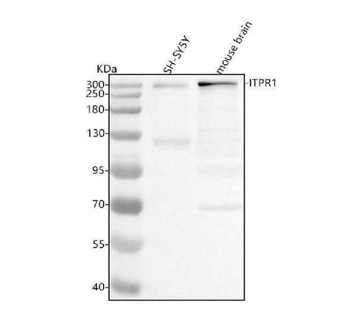 Anti-IP3 Receptor Rabbit Monoclonal Antibody Boster Bio