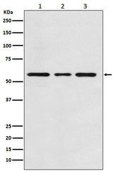 Anti-ACVRL1 Rabbit Monoclonal Antibody Boster Bio