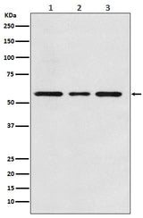 Anti-ACVRL1 Rabbit Monoclonal Antibody Boster Bio