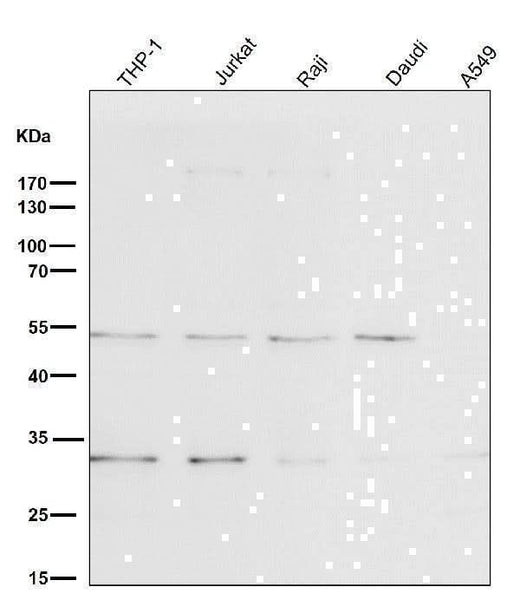 Anti-BNIP3 Rabbit Monoclonal Antibody Boster Bio