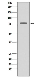 Anti-GRK2 ADRBK1 Rabbit Monoclonal Antibody Boster Bio