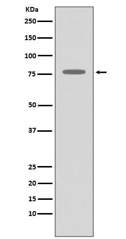 Anti-GRK2 ADRBK1 Rabbit Monoclonal Antibody Boster Bio