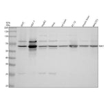 Anti-S6K1 RPS6KB1 Rabbit Monoclonal Antibody Boster Bio