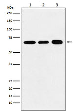 Anti-P70 S6 Kinase alpha Rabbit Monoclonal Antibody Boster Bio