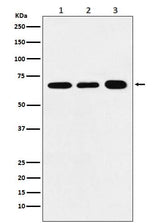Anti-P70 S6 Kinase alpha Rabbit Monoclonal Antibody Boster Bio