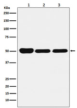 Anti-GLUR Rabbit Monoclonal Antibody Boster Bio