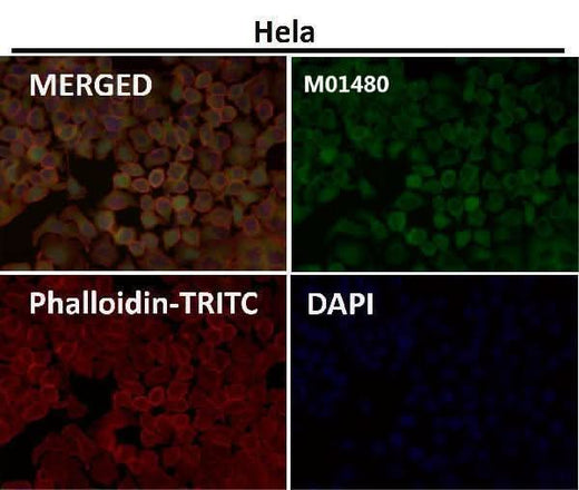 Anti-Profilin1 PFN1 Rabbit Monoclonal Antibody Boster Bio