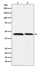 Anti-FEN1 Rabbit Monoclonal Antibody Boster Bio