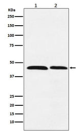 Anti-FEN1 Rabbit Monoclonal Antibody Boster Bio
