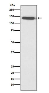 Anti-Ctip2 Rabbit Monoclonal Antibody Boster Bio