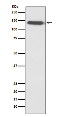 Anti-Ctip2 Rabbit Monoclonal Antibody Boster Bio