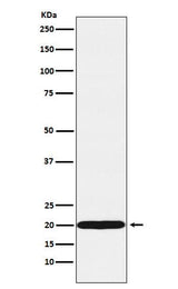 Anti-UBE2C Rabbit Monoclonal Antibody Boster Bio
