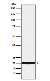 Anti-UBE2C Rabbit Monoclonal Antibody Boster Bio