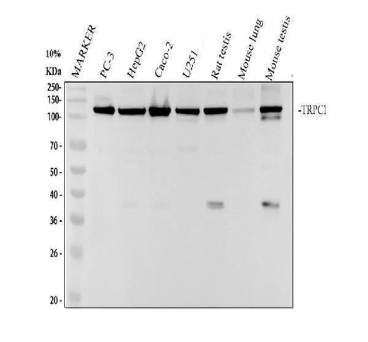 Anti-TRPC1 Rabbit Monoclonal Antibody Boster Bio