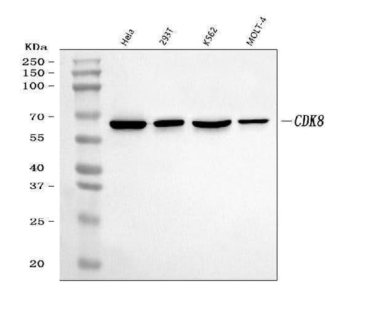 Anti-CDK8 Rabbit Monoclonal Antibody Boster Bio