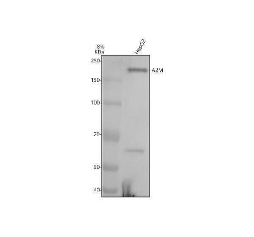 Anti-A2M/Alpha 2 Macroglobulin Rabbit Monoclonal Antibody Boster Bio