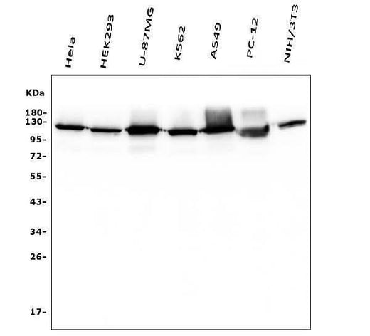 Anti-Hexokinase 1/HK1 Antibody Picoband® (monoclonal, 2I4 Boster Bio