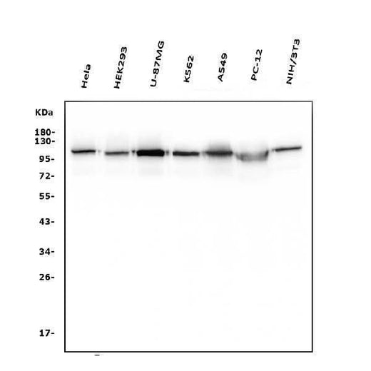 Anti-Hexokinase 1/HK1 Antibody Picoband® (monoclonal, 4B7 Boster Bio